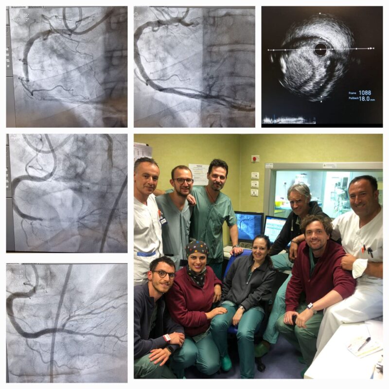 Procedura con laser eccimeri all'Ospedale dei Castelli: l'equipe medica che ha portato a termine i primi interventi